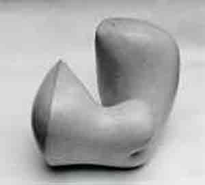 Human concretion
